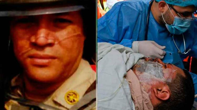Fallece uno de los bomberos trasladados a México Fallece uno de los bomberos trasladados a México