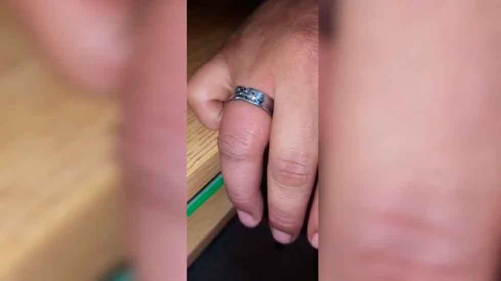 No hubo forma de sacarse el anillo y terminó en el cuartel de Bomberos