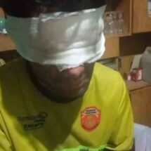 Un bombero voluntario resultó herido tras combatir un incendio en Pocito