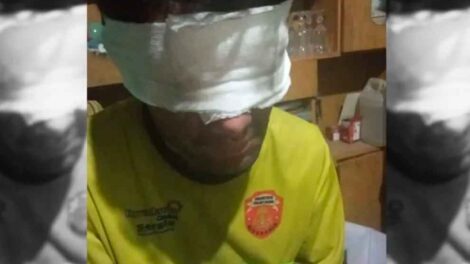 Un bombero voluntario resultó herido tras combatir un incendio en Pocito